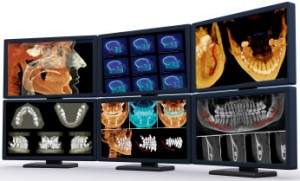 Computer Monitors showing dental images